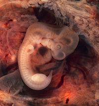 http://upload.wikimedia.org/wikipedia/commons/thumb/2/21/Tubal_Pregnancy_with_embryo.jpg/200px-Tubal_Pregnancy_with_embryo.jpg