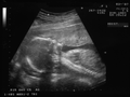 http://upload.wikimedia.org/wikipedia/commons/thumb/7/73/Scan20semanas1.png/120px-Scan20semanas1.png